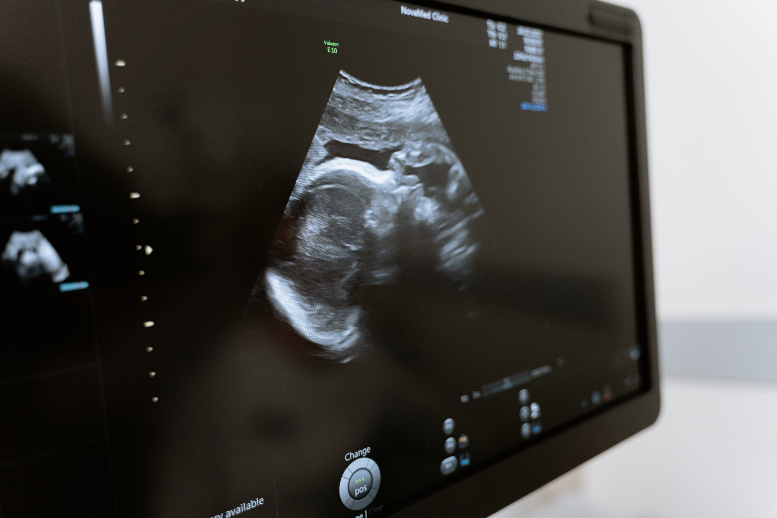 Read more about the article When Are You Going To Have Kids? Sensitive Topic Most People Don’t Understand