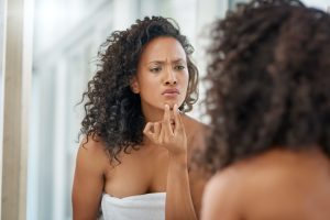 Read more about the article How to Stop Your Skin from Breaking Out